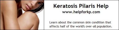 Keratosis Pilaris Help (Bumps on arms) - Learn about the common skin condition that affects half of the world's over-all population. HelpForKP.com - www.helpforkp.com